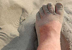 piedo mia kovrata per sablo- mein Fuß mit Sand bedeckt