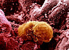 Human Embryo 6 Days Old
