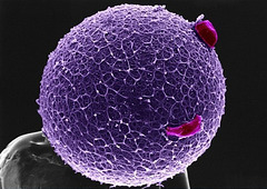 Human Ovule on the Top of a Pin