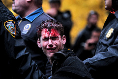 Bloody Protester - New York City