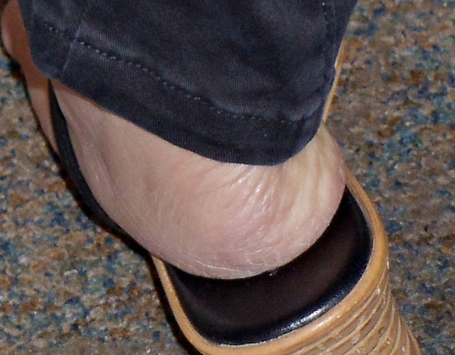 rough heel
