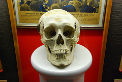 Vienna Criminal Museum – Skull of the serial killer Hugo Schenk
