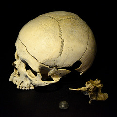 Rijksmuseum Boerhaave 2017 – Skull with shot wound and bullet
