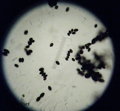 Panaeolus papilionaceus spores