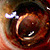 DOGMA 08 - untreated vision