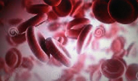 Blood Cells