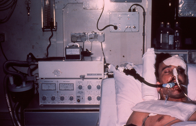 Patient on Servo-ventilator, Sept 1980