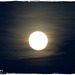 ANGERS