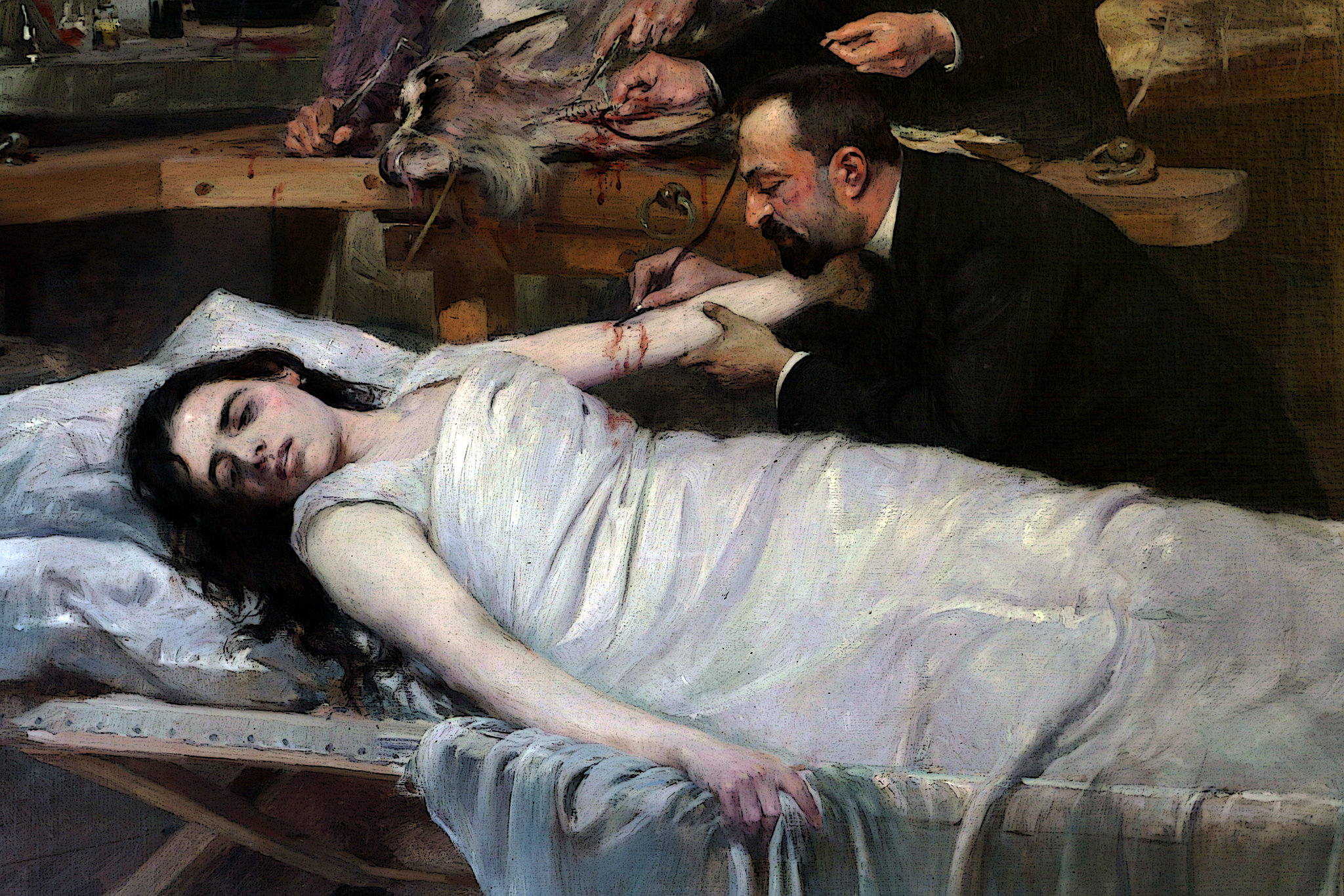 Transfusion de sang de chèvre