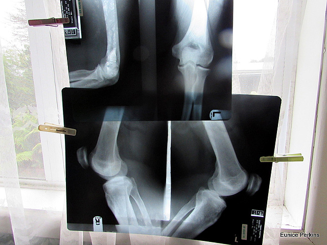 X-Rays