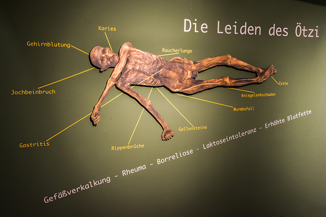 Aushang im Informationszentrum vom "Ötzidorf" in Umhausen: ... so gesund war Ötzi ...(© Buelipix)