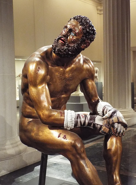 Detail of the Color Reconstruction of the Bronze Terme Boxer in the Metropolitan Museum of Art, December 2022