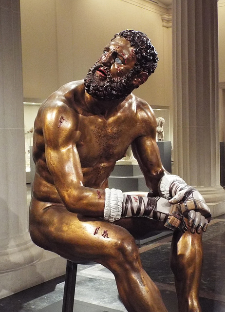 Detail of the Color Reconstruction of the Bronze Terme Boxer in the Metropolitan Museum of Art, December 2022