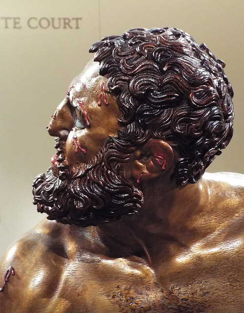 Detail of the Color Reconstruction of the Bronze Terme Boxer in the Metropolitan Museum of Art, December 2022