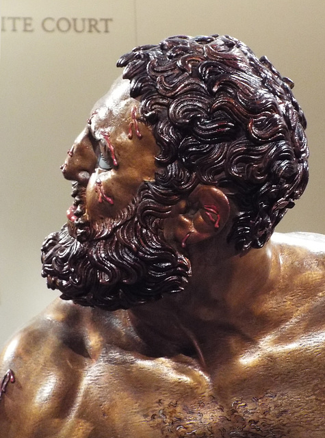 Detail of the Color Reconstruction of the Bronze Terme Boxer in the Metropolitan Museum of Art, December 2022