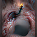 Endoscopy