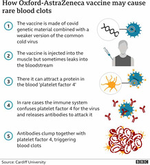 cvd - Oxford-AstraZeneca vaccine