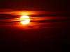 Sundown Syndrome