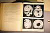 Turin 2017 – Museo Egizio – Research article of a skull
