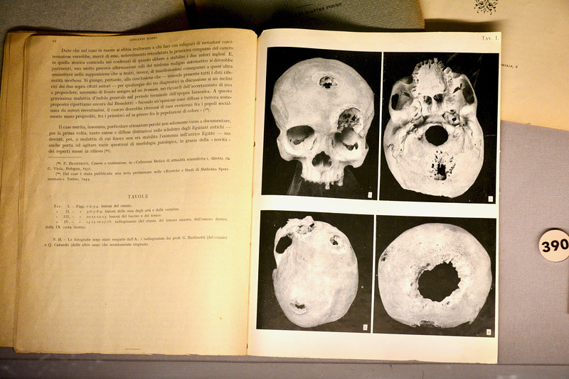 Turin 2017 – Museo Egizio – Research article of a skull