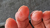 Fingerkuppen