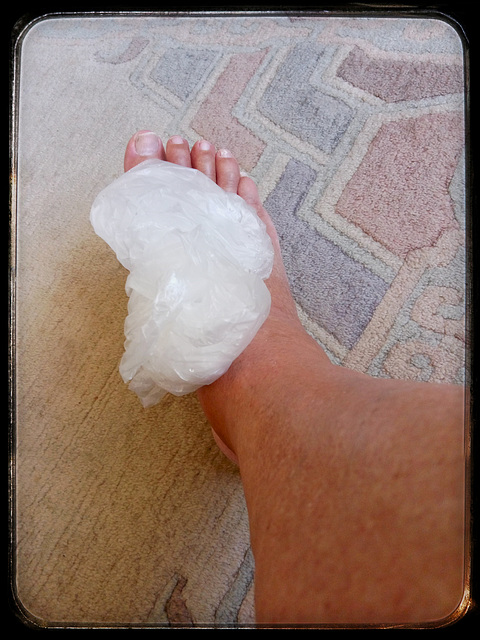 The gout of Henry VIII of England wasn't historically confirmed, but mine is accurately diagnosed