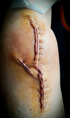 sewed knee  (PiP)